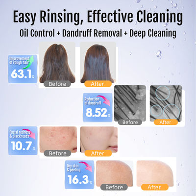 스파 및 뷰티용 초미세 나노 거품 발전기